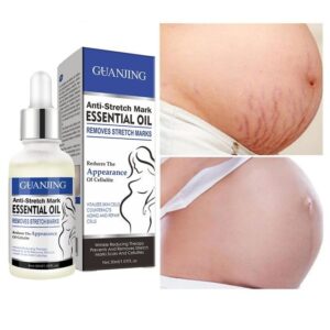 Guanjing stretch marks sérum - anti Vergetures